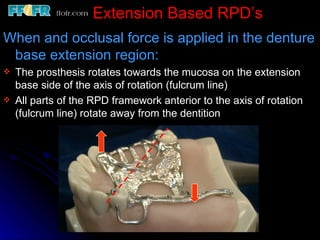 Flexbasd Rpd 2.rpd biomechanics | PPT