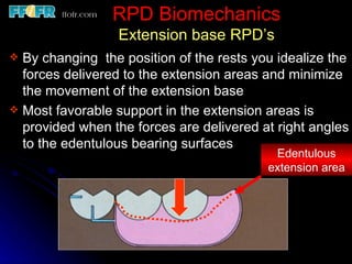 Skeletal Rests Design Rpd 2.rpd biomechanics | PPT