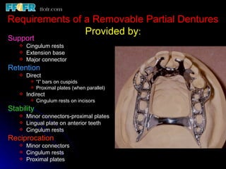 Continuous Rest Rpd 2.rpd biomechanics | PPT