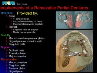 Mesial Rest Rpd 2.rpd biomechanics | PPT