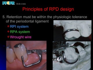 2.rpd biomechanics | PPT