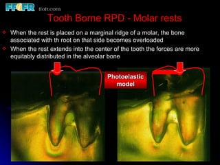 2.rpd biomechanics | PPT
