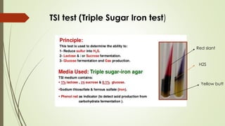 TSI test (Triple Sugar Iron test)
Red slant
H2S
Yellow butt
 