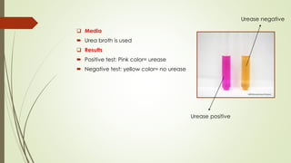 ❑ Media
 Urea broth is used
❑ Results
 Positive test: Pink color= urease
 Negative test: yellow color= no urease
Urease positive
Urease negative
 