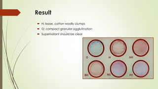 Result
 H: loose, cotton woolly clumps
 O: compact granular agglutination
 Supernatant should be clear
 