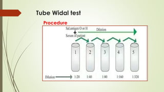 Tube Widal test
Procedure
 