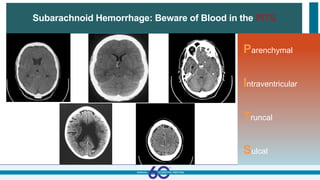 Subarachnoid Hemorrhage: Beware of Blood in the PITS
Parenchymal
Intraventricular
Truncal
Sulcal
 