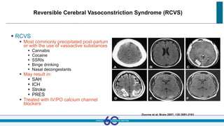 Reversible Cerebral Vasoconstriction Syndrome (RCVS)
 RCVS
 Most commonly precipitated post-partum
or with the use of vasoactive substances
 Cannabis
 Cocaine
 SSRIs
 Binge drinking
 Nasal decongestants
 May result in:
 SAH
 ICH
 Stroke
 PRES
 Treated with IV/PO calcium channel
blockers
Ducros et al. Brain 2007; 130:3091-3101
 