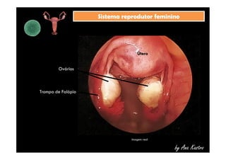 SSiisstteemmaa rreepprroodduuttoorr ffeemmiinniinnoo 
OOvváárriiooss 
ÚÚtteerroo 
by Ana Kastro 
TTrroommppaa ddee FFaallóóppiioo 
Imagem real 
 