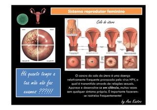 SSiisstteemmaa rreepprroodduuttoorr ffeemmiinniinnoo 
Colo do útero 
O cancro do colo do útero é uma doença 
relativamente frequente provocada pelo vírus HPV, o 
qual é transmitido através de relações sexuais. 
Aparece e desenvolve-se em silêncio, muitas vezes 
sem qualquer sintoma próprio. É importante fazerem-se 
by Ana Kastro 
rastreios frequentemente! 
Há quanto tempo a 
tua mãe não faz 
exames ???!!! 
 