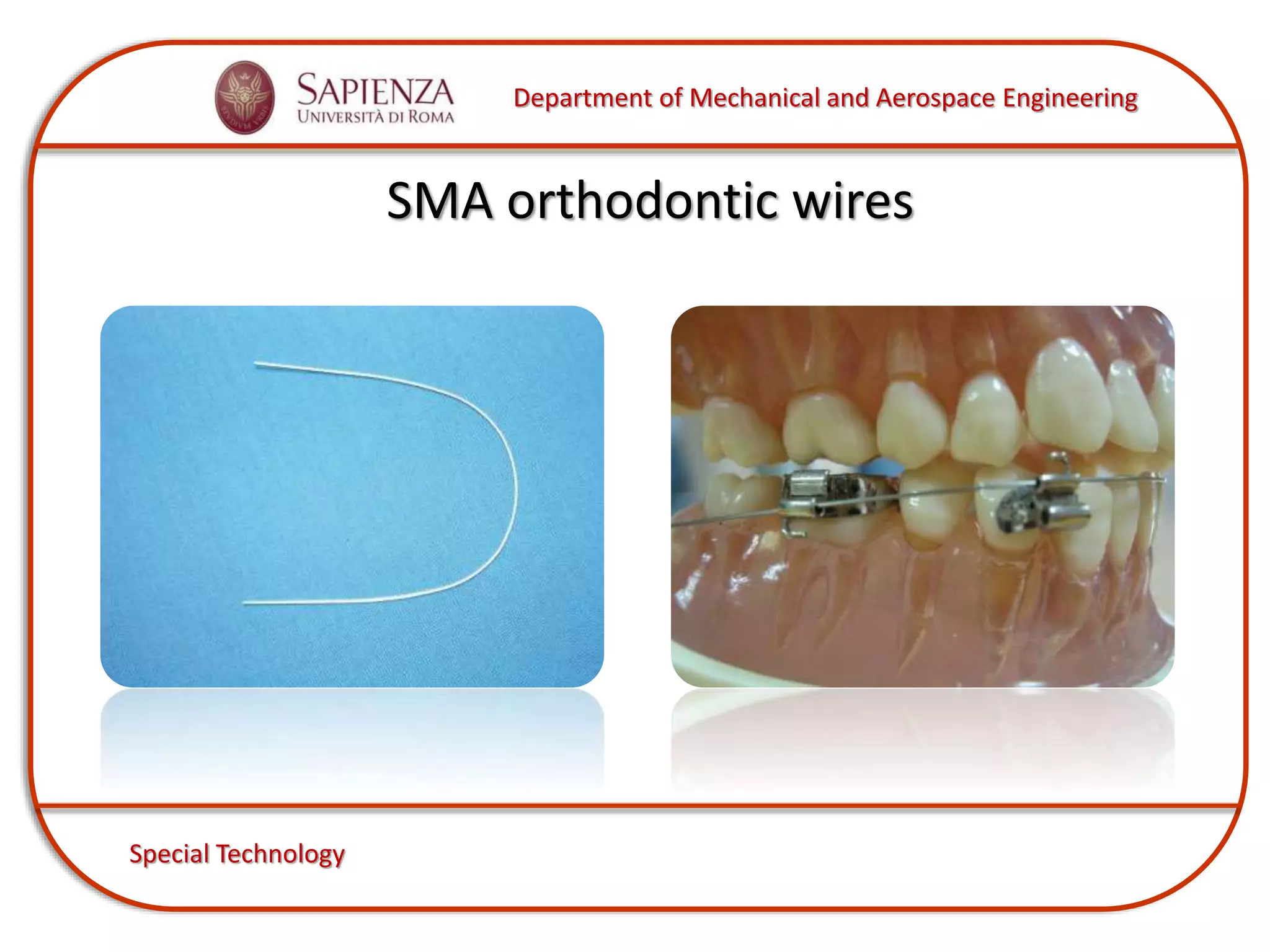 Department of Mechanical and Aerospace Engineering
Special Technology
SMA orthodontic wires
 