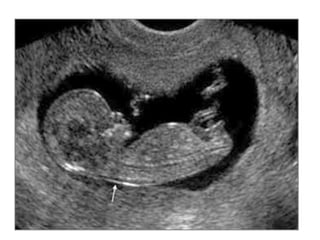 2  Spermatogenesis &amp; Oogenesis