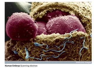 Human Embryo Scanning electron
 