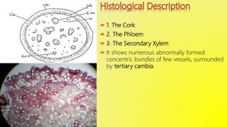  1. The Cork
 2. The Phloem
 3. The Secondary Xylem
 It shows numerous abnormally formed
concentric bundles of few vessels, surrounded
by tertiary cambia.
 