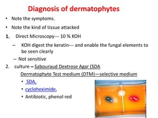 Diagnosis of dermatophytes
• Note the symptoms.
• Note the kind of tissue attacked
1. Direct Microscopy--- 10 % KOH
– KOH digest the keratin--- and enable the fungal elements to
be seen clearly
– Not sensitive
2. culture – Sabouraud Dextrose Agar (SDA
Dermatophyte Test medium (DTM)—selective medium
• SDA,
• cycloheximide,
• Antibiotic, phenol red
 