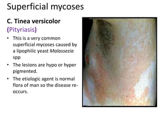 Superficial mycoses
C. Tinea versicolor
(Pityriasis)
• This is a very common
superficial mycoses caused by
a lipophilic yeast Malassezia
spp
• The lesions are hypo or hyper
pigmented.
• The etiologic agent is normal
flora of man so the disease re-
occurs.
 
