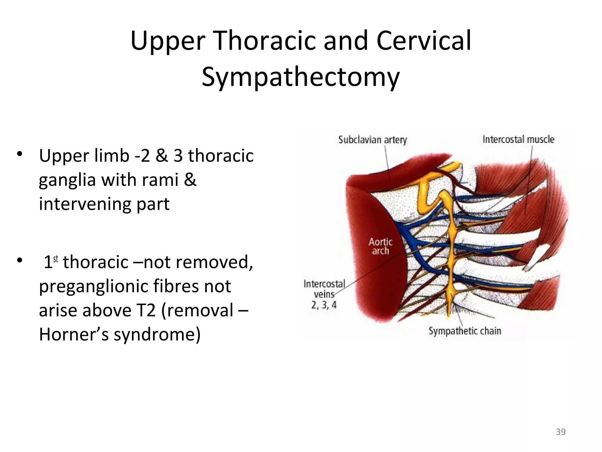 39
Upper Thoracic and Cervical
Sympathectomy
• Upper limb -2 & 3 thoracic
ganglia with rami &
intervening part
• 1st
thoracic –not removed,
preganglionic fibres not
arise above T2 (removal –
Horner’s syndrome)
 