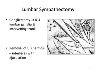 Lumbar Sympathectomy
• Gangliectomy -3 & 4
  lumbar ganglia &
  intervening trunk




• Removal of LI is harmful
  – inter...