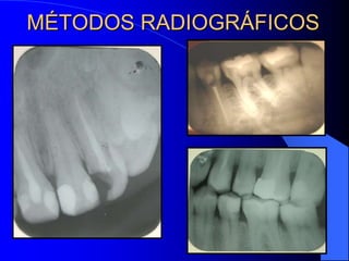 MÉTODOS RADIOGRÁFICOS

 