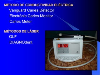 MÉTODO DE CONDUCTIVIDAD ELÉCTRICA

Vanguard Caries Detector
Electrónic Caries Monitor
Caries Meter
MÉTODOS DE LÁSER

QLF
DIAGNOdent

 