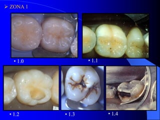  ZONA 1

• 1.1

• 1.0

• 1.2

• 1.3

• 1.4

 