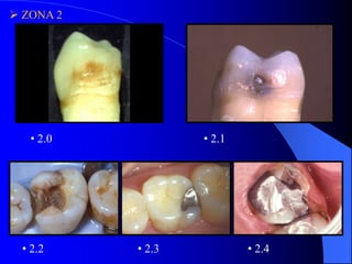  ZONA 2

• 2.0

• 2.2

• 2.1

• 2.3

• 2.4

 