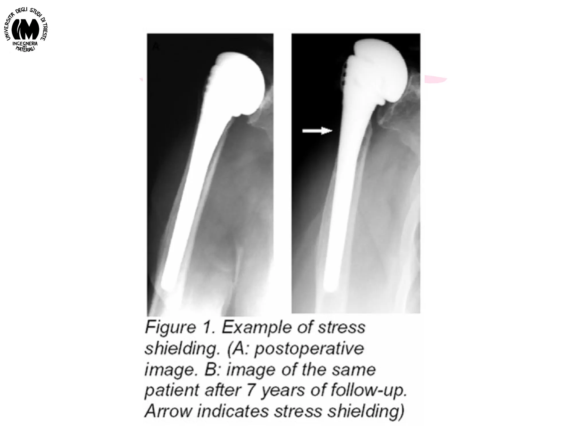 Biomateriali - Prof. O. Sbaizero
 