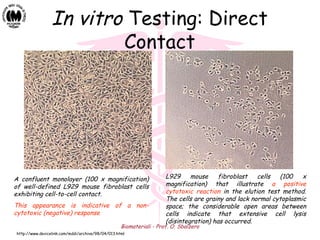 Biomateriali - Prof. O. Sbaizero
In vitro Testing: Direct
Contact
A confluent monolayer (100 x magnification)
of well-defined L929 mouse fibroblast cells
exhibiting cell-to-cell contact.
This appearance is indicative of a non-
cytotoxic (negative) response
L929 mouse fibroblast cells (100 x
magnification) that illustrate a positive
cytotoxic reaction in the elution test method.
The cells are grainy and lack normal cytoplasmic
space; the considerable open areas between
cells indicate that extensive cell lysis
(disintegration) has occurred.
http://www.devicelink.com/mddi/archive/98/04/013.html
 