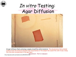 Biomateriali - Prof. O. Sbaizero
In vitro Testing:
Agar Diffusion
http://www.devicelink.com/mddi/archive/98/04/013.html
An agar diffusion flask containing a sample of positive control material. The discoloration that extends
outward from the material indicates that the presence of the sample has caused the cells to lyse, losing
the vital stain incorporated in the agar layer.
 