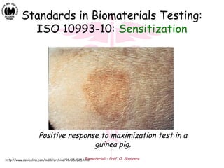 Biomateriali - Prof. O. Sbaizero
Standards in Biomaterials Testing:
ISO 10993-10: Sensitization
Positive response to maximization test in a
guinea pig.
http://www.devicelink.com/mddi/archive/98/05/025.html
 