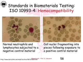 Biomateriali - Prof. O. Sbaizero 58
Standards in Biomaterials Testing:
ISO 10993-4: Hemocompatibility
Normal neutrophils and
lymphocytes subjected to a
negative control material
http://www.devicelink.com/mddi/archive/98/11/009.html
Cell nuclei fragmenting into
pieces following exposure to
a positive control material
 