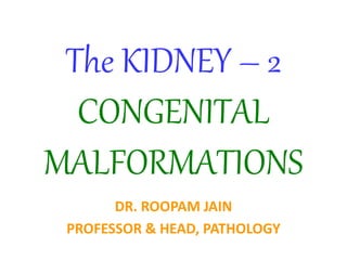 The KIDNEY – 2
CONGENITAL
MALFORMATIONS
DR. ROOPAM JAIN
PROFESSOR & HEAD, PATHOLOGY
 