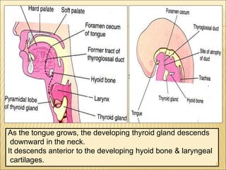 As the tongue grows, the developing thyroid gland descends
downward in the neck.
It descends anterior to the developing hyoid bone & laryngeal
cartilages. 20
 