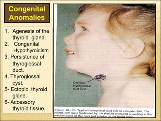 1. Agenesis of the
thyroid gland.
2. Congenital
Hypothyroidism
3. Persistence of
thyroglossal
duct.
4. Thyroglossal
cyst.
5- Ectopic thyroid
gland.
6- Accessory
thyroid tissue.
Congenital
Anomalies
23
 