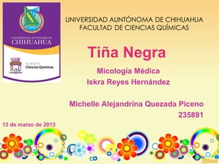 Tiña Negra
Micología Médica
Iskra Reyes Hernández
Michelle Alejandrina Quezada Piceno
235891
13 de marzo de 2013
 