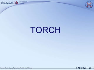 TORCH
 