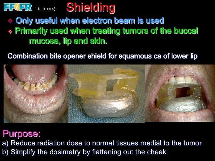 2.use of splints and stents during radiation therapy