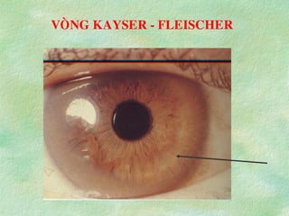 VOØNG KAYSER - FLEISCHER
 