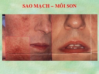 SAO MAÏCH – MOÂI SON
 