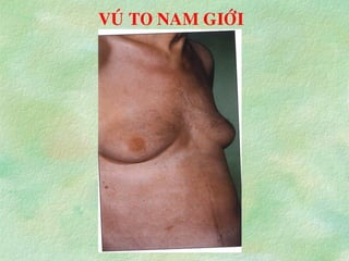 VUÙ TO NAM GIÔÙI
 