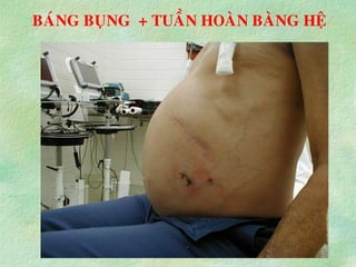 BAÙNG BUÏNG + TUAÀN HOAØN BAØNG HEÄ
 