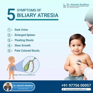 5 Symptoms Of Biliary Atresia