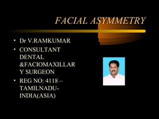 FACIAL ASYMMETRY 
• Dr V.RAMKUMAR 
• CONSULTANT 
DENTAL 
&FACIOMAXILLAR 
Y SURGEON 
• REG NO: 4118 – 
TAMILNADU-INDIA( 
ASIA) 
 