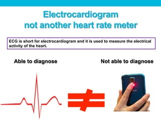 Electrocardiogram
not another heart rate meter
ECG is short for electrocardiogram and it is used to measure the electrical
activity of the heart.
Able to diagnose Not able to diagnose