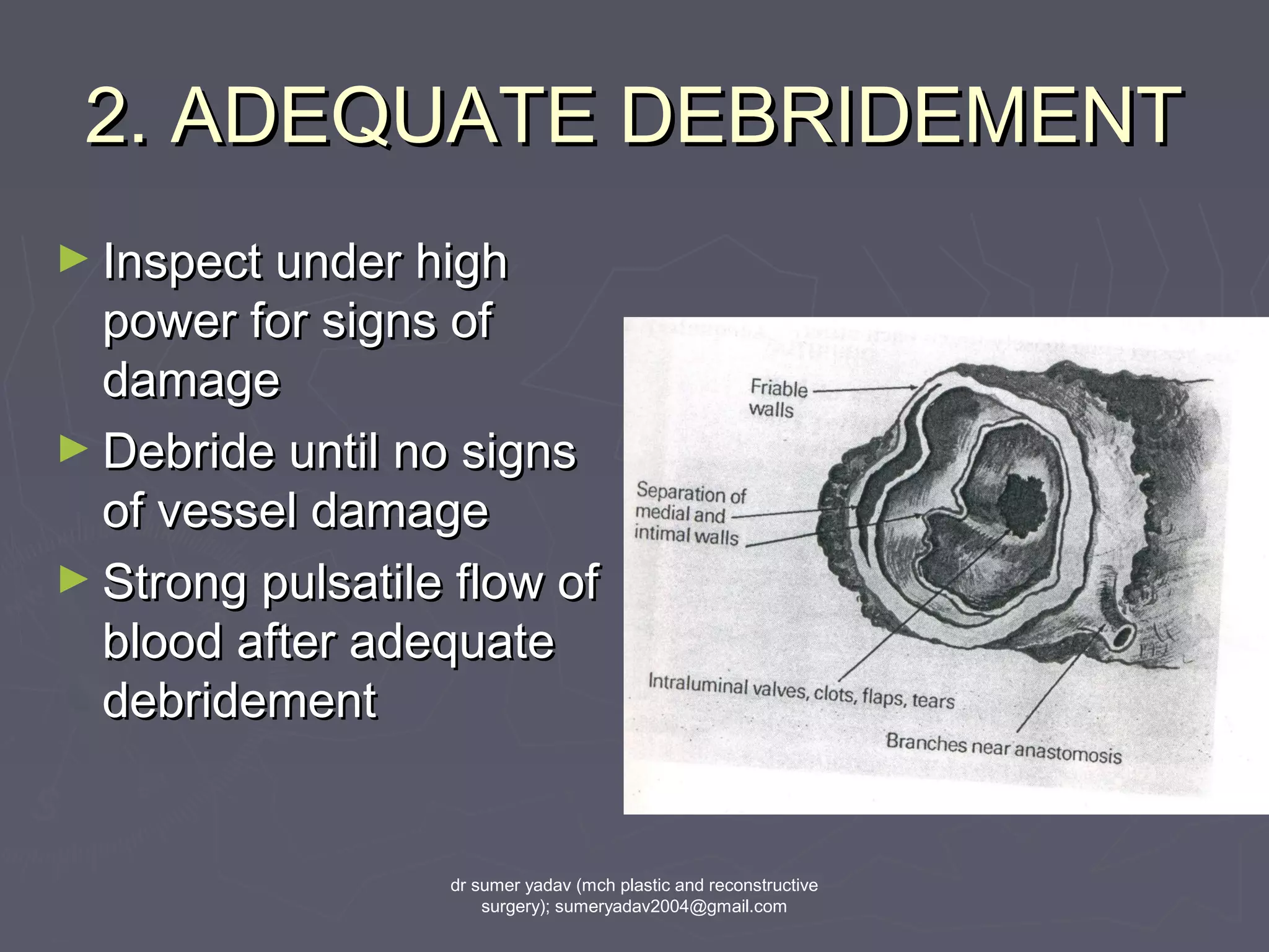 2. ADEQUATE DEBRIDEMENT2. ADEQUATE DEBRIDEMENT
► Inspect under highInspect under high
power for signs ofpower for signs of
damagedamage
► Debride until no signsDebride until no signs
of vessel damageof vessel damage
► Strong pulsatile flow ofStrong pulsatile flow of
blood after adequateblood after adequate
debridementdebridement
dr sumer yadav (mch plastic and reconstructive
surgery); sumeryadav2004@gmail.com
 