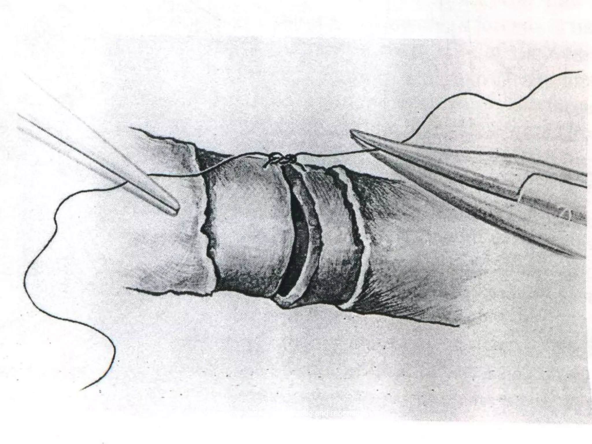 dr sumer yadav (mch plastic and reconstructive
surgery); sumeryadav2004@gmail.com
 