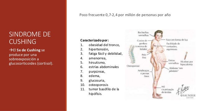 Enfermedad y Síndrome de Cushing