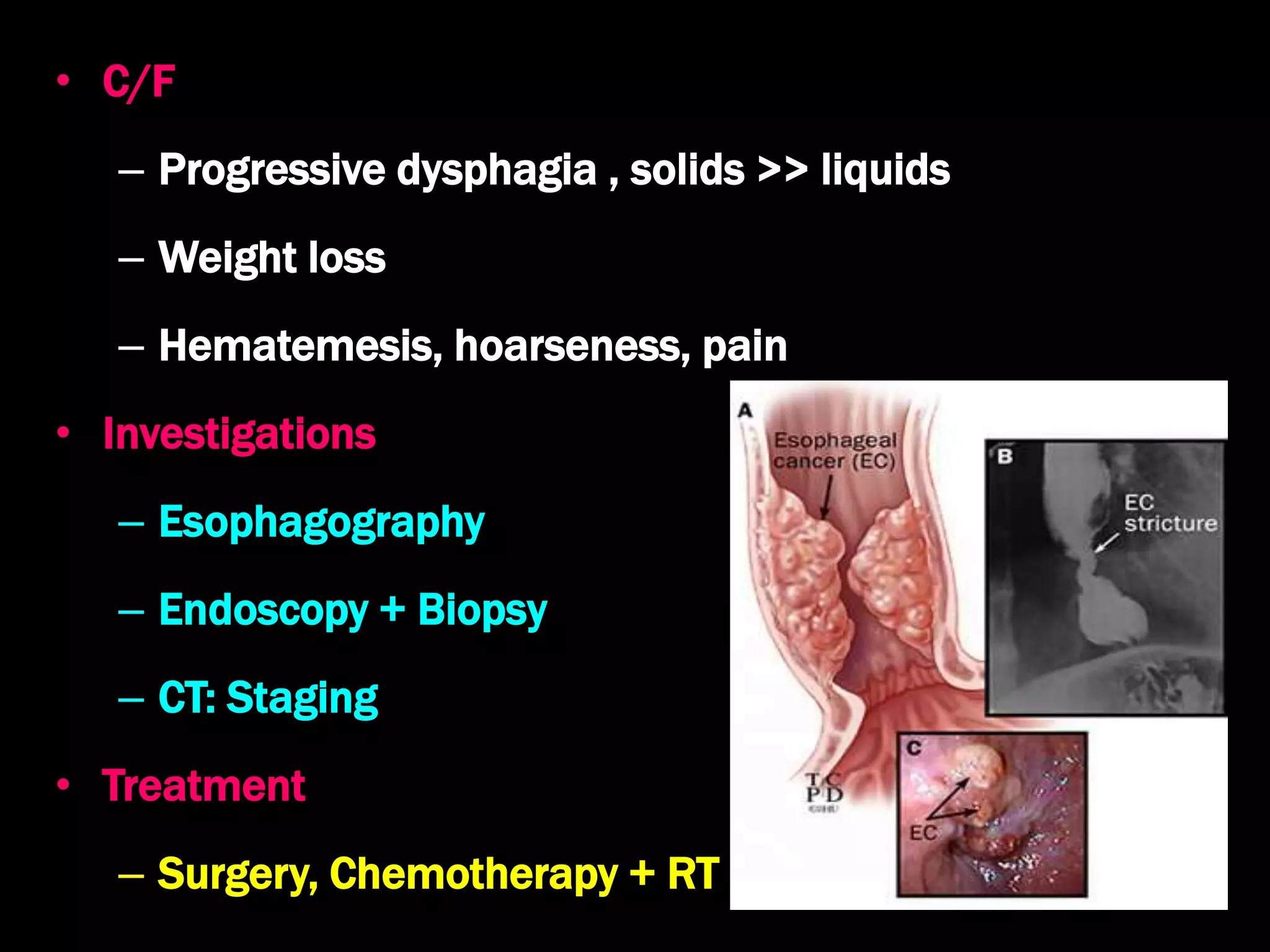 Evaluation of dysphagia and diseases of the esophagus | PPTX