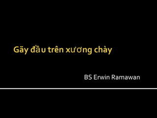 Gãy đ u trên x ng chàyầ ươ
BS Erwin Ramawan
 
