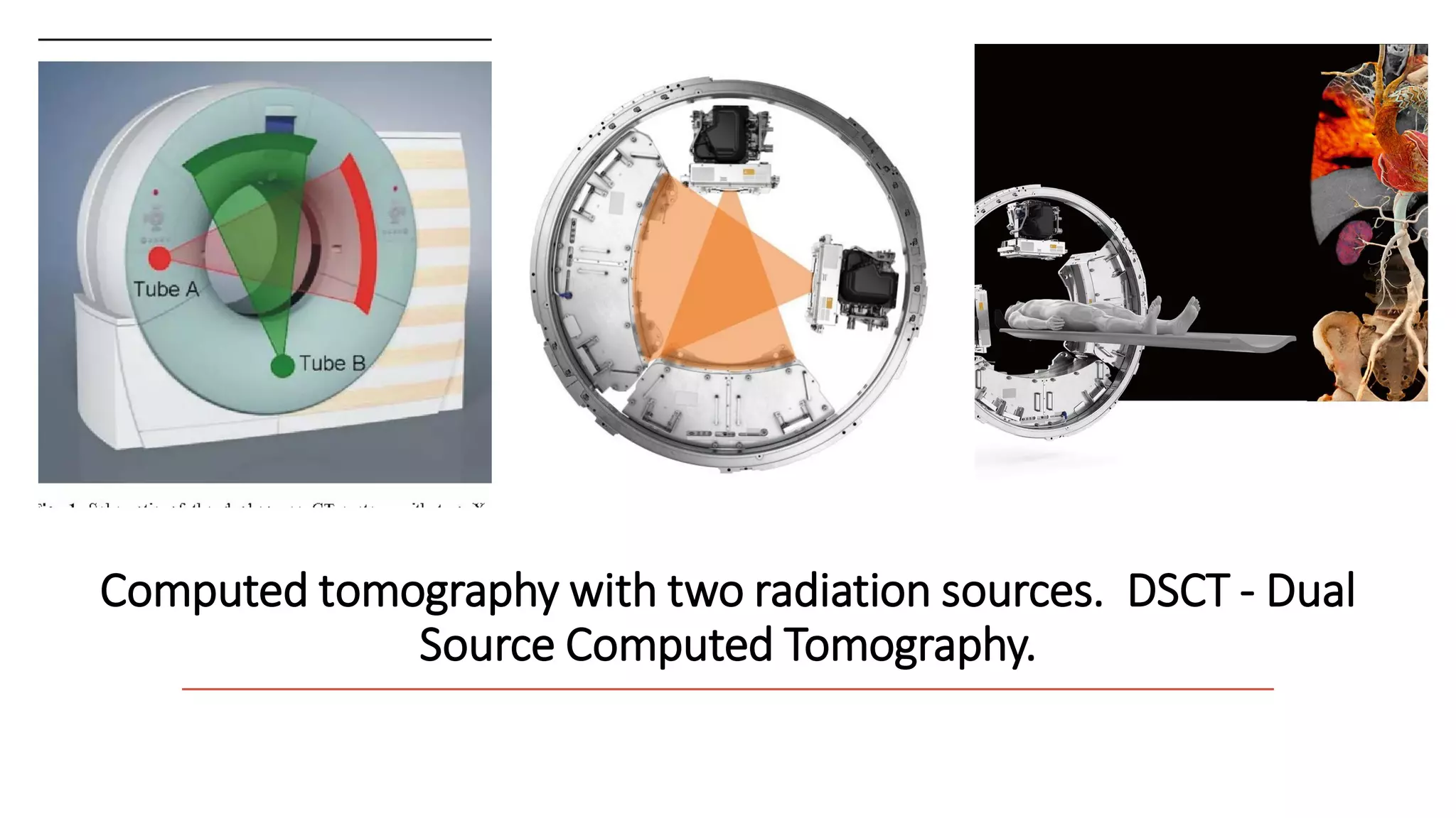 Computed tomography with two radiation sources. DSCT - Dual
Source Computed Tomography.​
 